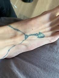 Removing tattoos with lasers is tricky business as surgeons be very cautious to ensure the skin is tetrafluoroethane has one unfortunate property: Want To Have This 6 Year Old Tat Removed Black Blue Green What Should I Expect Tattooremoval