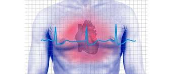 Cardíaco se refiere al músculo cardiaco, síncope cardíaco así una pérdida repentina de la conciencia que es causada por un suministro insuficiente de sangre oxigenada circula por los vasos sanguíneos del cerebro. Descubren Una Nueva Causa Para El Sincope Cardiaco Ciencia Y Tecnologia Opinion Bolivia