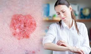 But experts say nine out of 10 cases could be prevented if people protected their skin with a high factor sun know your moles! Skin Cancer Symptoms Six Signs Of Non Melanoma Look At Your Body Newsbeezer