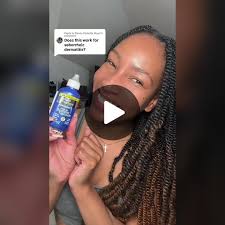 Replying to @Ebony Ricketts Skyer yes, it does!! #seborrheicdermatitis...