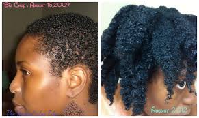 For restoration 5 pack hair growth serum,ginger biotin hair regrowth oil prevent hair loss and natural serum for thicker, stronger, longer hair men and women. Reflections 3 Years Post Big Chop Veepeejay