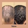 You can start putting these strategies into play today, and with any luck you'll regain your hair loss in short order. 1