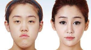 Maybe you would like to learn more about one of these? Plastic Surgery The Quest For The Perfect Selfie In South Korea