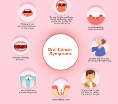 Image result for gum cancer symptoms