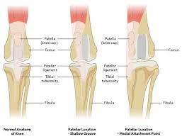 This lengthy bone connects with the knee at one finish and the ankle on the different. Luxating Patella In Cats Vca Animal Hospital