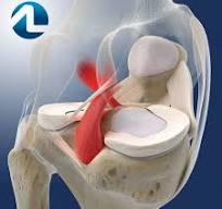 O que é Ligamento Cruzado Posterior - Especialista do Joelho ...
