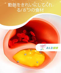 積極的に食べたい 動脈の詰まりを予防する7つの食べ物 みんな健康 健康 自然療法 食べ物