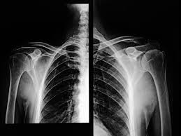 How Health Care Data And Lax Rules Help China Prosper In Ai Health Care Health Inspiration Pictures Health