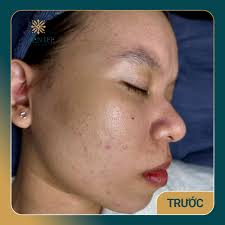 Thẩm mỹ Uyên Lee