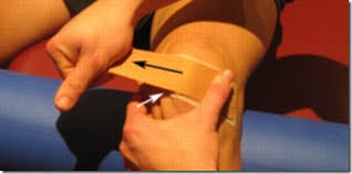 Tape In The Management Of Patellofemoral Pain Claire Patella