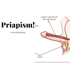 Image result for Priapism
