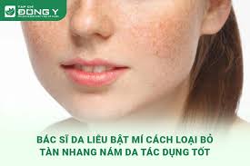Bác Sĩ Da Liễu Bật Mí Cách Trị Nám Tàn Nhang Hiệu Quả
