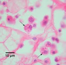 Image result for Bonamia