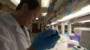 Ovarian cancer is deadly and generally diagnosed at late stage when the chances of survival are low. Beating Ovarian Cancer Mayo Clinic