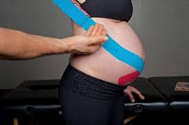 The spidertech groin spider relieves pain and. Here S How Kinesiology Taping Techniques Can Help Your Pregnant Clients Massage Magazine