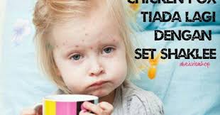 1 год, 10 месяцев ago passed. Sembuh Daripada Chicken Pox Dalam Masa Seminggu Dan Tiada Kesan Parut