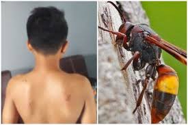 Di sebalik hukum alam yang dilaksanakan, lebah juga menjadi 'musuh' manusia sekiranya serangga berkelompok ini berasa terancam dengan kehadiran entiti lain termasuk binatang ternakan. Bahaya Sengatan Tawon Seorang Pria Tewas Karenanya Ini Ciri Manusia Yang Berisiko Semua Halaman Grid Health