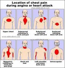 Pin By Ana Corral On Nursing Medical Nursing Care Cardiac Nursing Nursing Care Plan