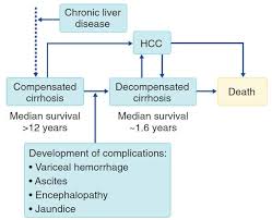 23 2.2 konsep asuhan keperawatan 2.2.1 pengkajian pengkajian merupakan tahap awal dari proses dan merupakan suatu proses yang sistematis dalam pengumpulan data dari berbagai sumber data. Patofisiologi Dan Patogenesis Sirosis Hati Kedokteran Caiherang