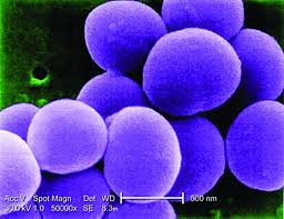 Pvl is a toxin produced by certain types of staphylococcus aureus. Four Syndromes Suggest Life Threatening Pvl Positive S Aureus Infection Pulmonary Health Hub
