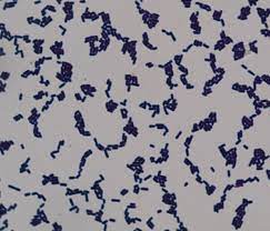 Check spelling or type a new query. Gram Stained Smear Of Pure Culture Of Clostridium Perfringens Showing Download Scientific Diagram