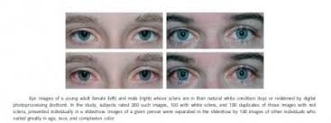 Последние твиты от bloodshot eyes (@bloodshoteyes1). Is Beauty Found In The Whites Of The Eyes Red Eyes Associated With The Sad And Unattractive Eurekalert Science News