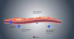 Early antibiotic treatment for pseudomonas aeruginosa eradication in patients with cystic fibrosis: Mukoviszidose Zystische Fibrose Cf Gesundheitsprobleme Von Kindern Msd Manual Ausgabe Fur Patienten