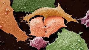 You may not notice any symptoms of lung cancer ― many people don't. Lung Cancer In Non Smokers Likely To Respond Differently To Treatment The Institute Of Cancer Research London