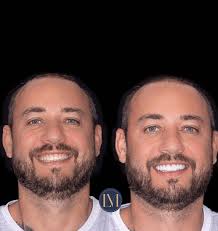 Luiz Marotti (@drluizmarotti) · Instagram 照片和视频