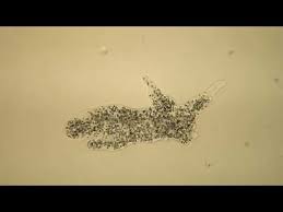 This is a great view of cytoplasmic streaming, showing how an amoeba moves around by getting its cytoplasm to move to different parts of the . Amoeba Under The Microscope Youtube