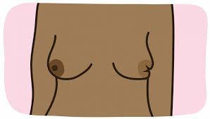 Breast cancer lumps are usually very hard and are often irregularly shaped. Breast Cancer Symptoms Breast Cancer Now