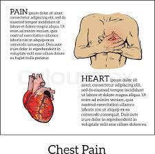 A collection of anatomy notes covering the key anatomy concepts that medical students need to learn. Information About Heart Pain Chest Stock Vector Colourbox