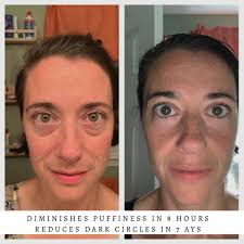 Pregnant skin care products with no retinol