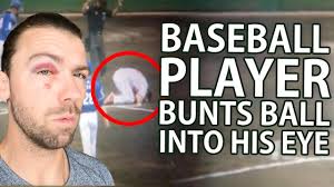 Baseball Player Bunts Ball Into His EYE?!