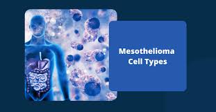 Alternative treatments that have shown some promise in helping people cope with breathlessness include: Mesothelioma Cell Types How Cell Type Can Affect Prognosis