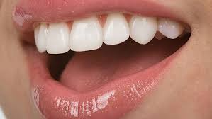 Tandplak is de nummer één boosdoener van gingivitis. Tandvleesontsteking Verhelpen 5 Tips Ter Behandeling Van Gingivitis Gezondr Nl