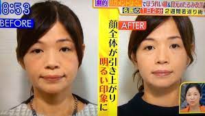 リガメントで法令線が薄くなる リガメントほぐし 顔ヨガ 美容