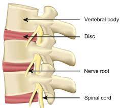 Spine Specialist Near Farmington, MO | Back Pain Relief | Axes Physical  Therapy