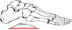 Sharp, burning or shooting pain near your toes (ball of your foot), feels like a lump or small stone under your foot. Massage For Foot Pain Arch Muscles