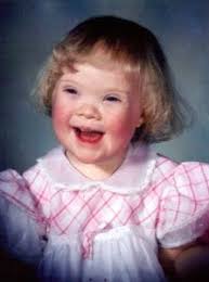 Is Your Home Influenced by Down Syndrome (Trisomey 21)?