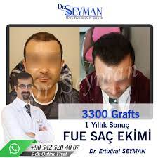 Antalya Sac Ekimi Sac Ince Saclar Saglikli Sac