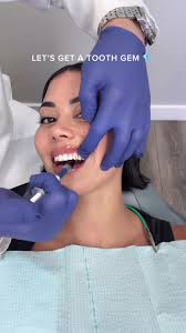 Top Dentist Recommendations in San Diego for Tooth Gems