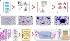 Image result for Primary Tumor Localization