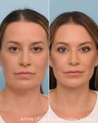 Balikian Plastic Surgery