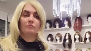 Helping people with hair loss makes my day, stylist with alopecia says