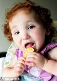 Girl who never learned to eat enjoys first taste of real food