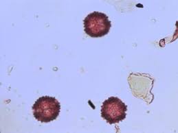 Image result for Tolpis