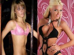 Loredana arata din ce in ce mai bine si asta ne face sa ne intrebam daca nu cumva apeleaza la medicii esteticieni. Facebook