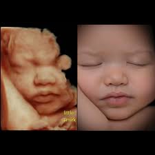 Babys Bungalow 3D/4D & HD-Live Ultrasound
