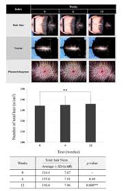 Maybe you would like to learn more about one of these? Cosmetics Free Full Text Broussonetia Papyrifera Promotes Hair Growth Through The Regulation Of B Catenin And Stat6 Target Proteins A Phototrichogram Analysis Of Clinical Samples Html